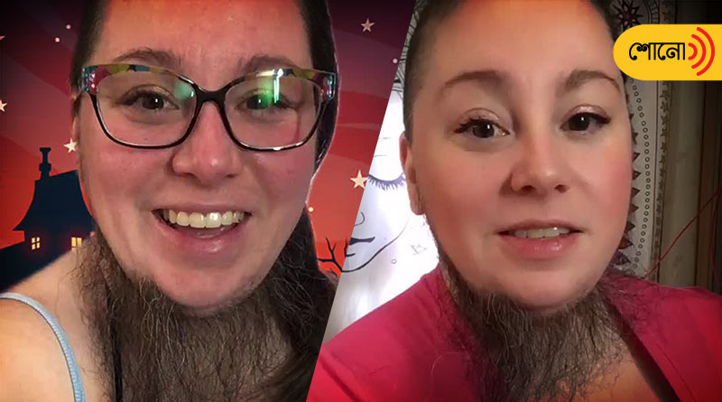 A bearded woman is encouraging women to be themselves