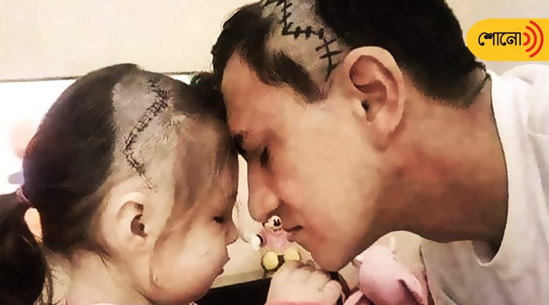 father shaved his head to express solidarity with daughter