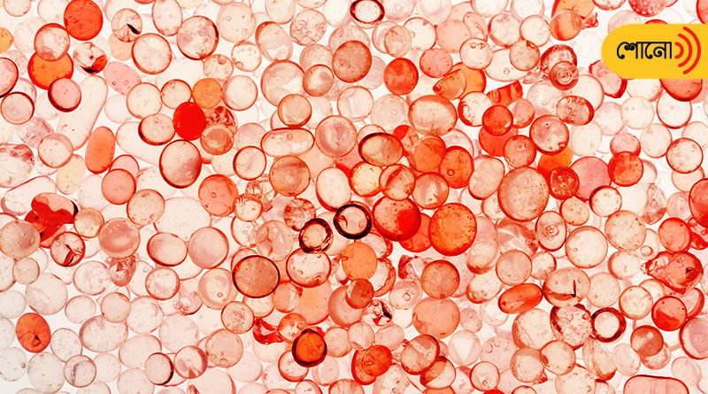 Scientist found microplastics in human blood for the first time
