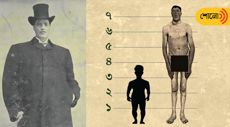 Adam Rainer is the only man in history to have been recorded as a dwarf and a giant during his lifetime