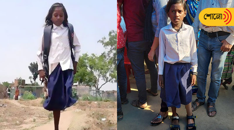 Bihar girl gets prosthetic leg after video went viral