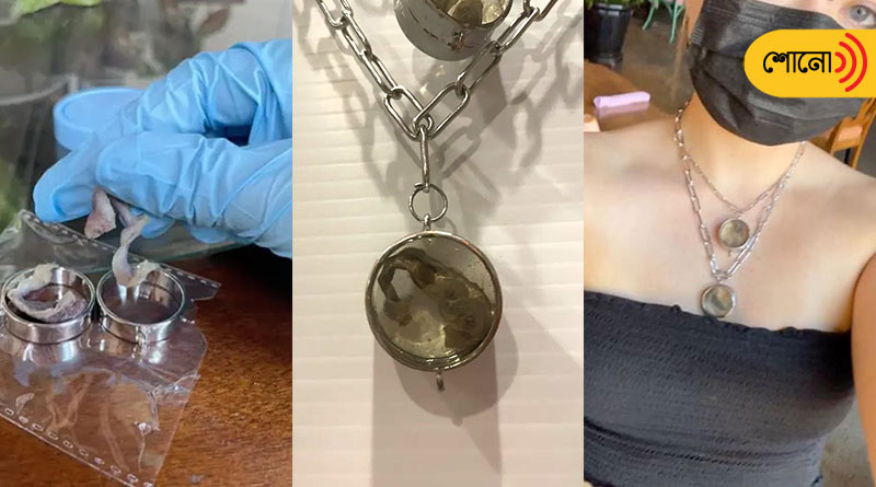 American woman turned her fallopian tubes into a necklace